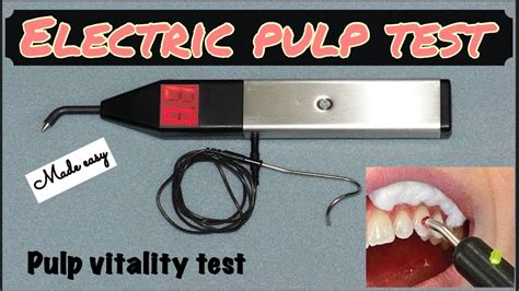 Beating Pulp Tester purchase|electric pulp test normal values.